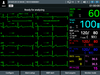 Defibrylator defiMASTER ręczny i AED - Basic