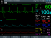 Defibrylator + kardiomonitor defiMASTER ręczny i AED - Advance